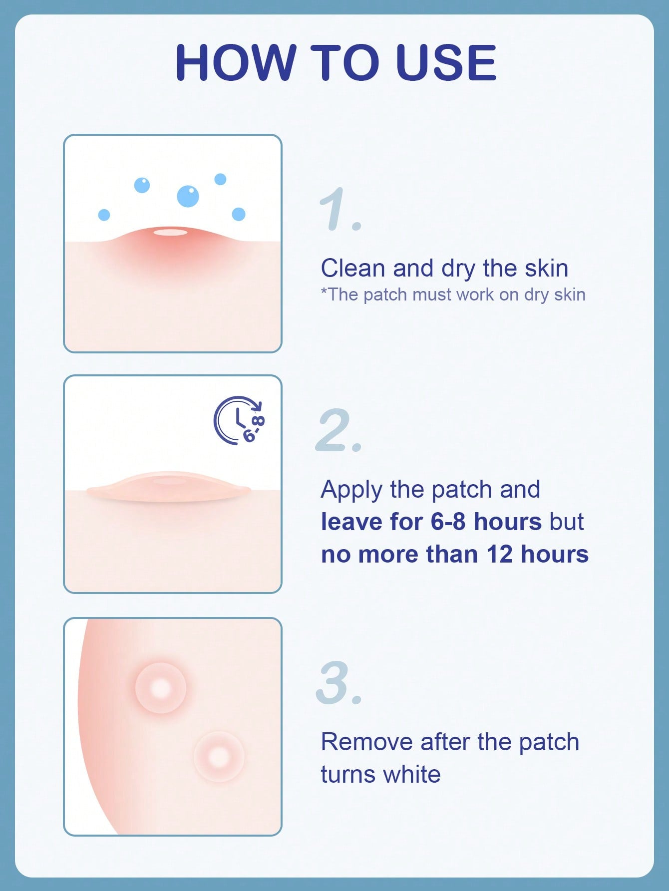 SlowSunday Hydrocolloid Acne Pimple Night Patch 12 PCS, For Covering Zits And Blemishes, Spot Stickers For Face And Skin, Overnight Working Spot Patches Pimple Patches For Acne