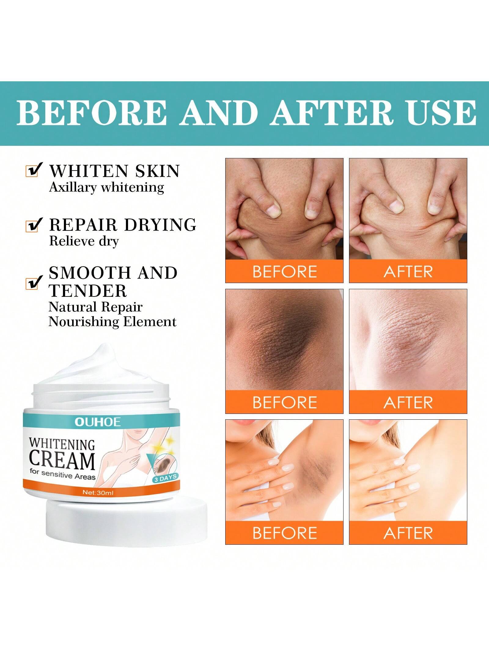 30ml Underarm Whitening Cream Lighten Underarm Joints Elbow  Hydrating Skin Brightening Cream